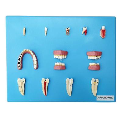 Patologia Dentárias Em 12 Peças, Anatomia