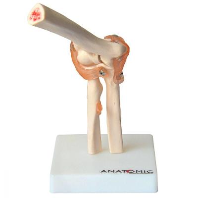 Articulação do Cotovelo com Ligamentos Esqueleto Anatomic