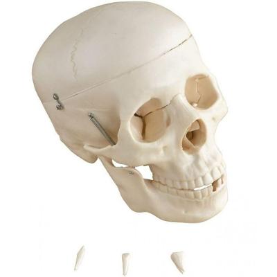 Crânio Humano Mandíbula E Calota Móvel E 3 Dentes Móveis