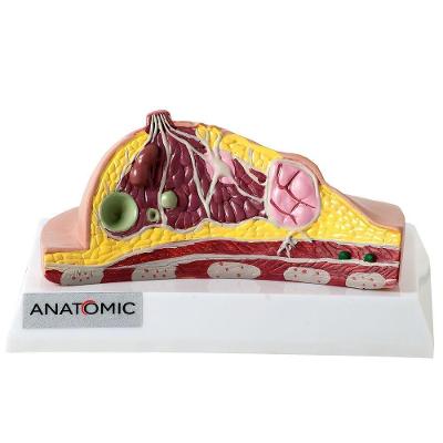 Mama Dissecada com Patologias Anatomic